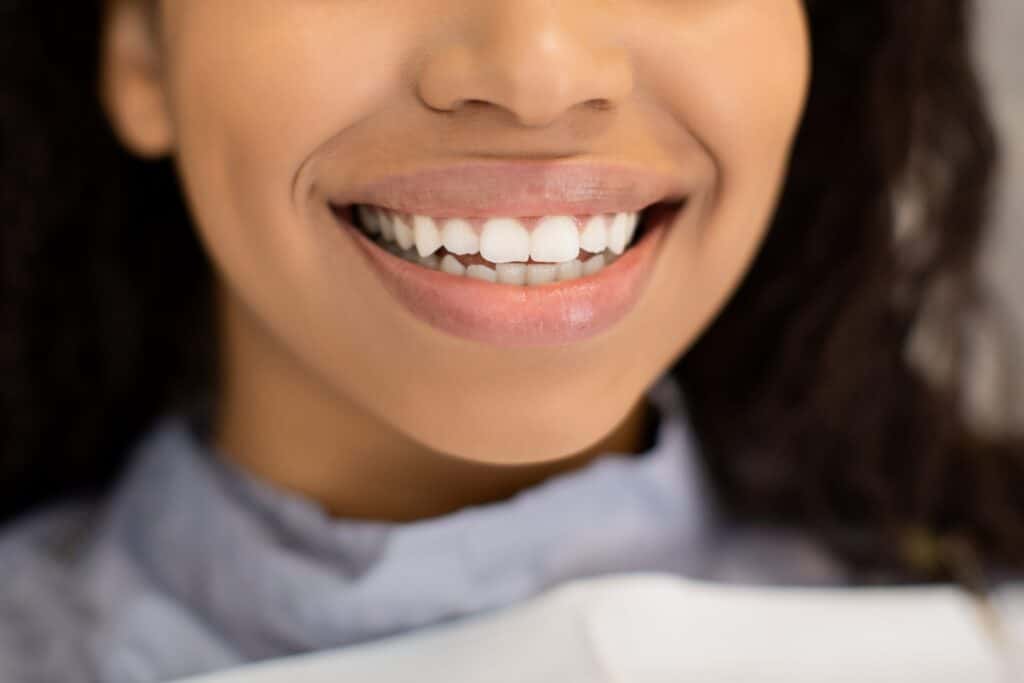 Lady Widely Smiling With Her Perfect Healthy White Teeth