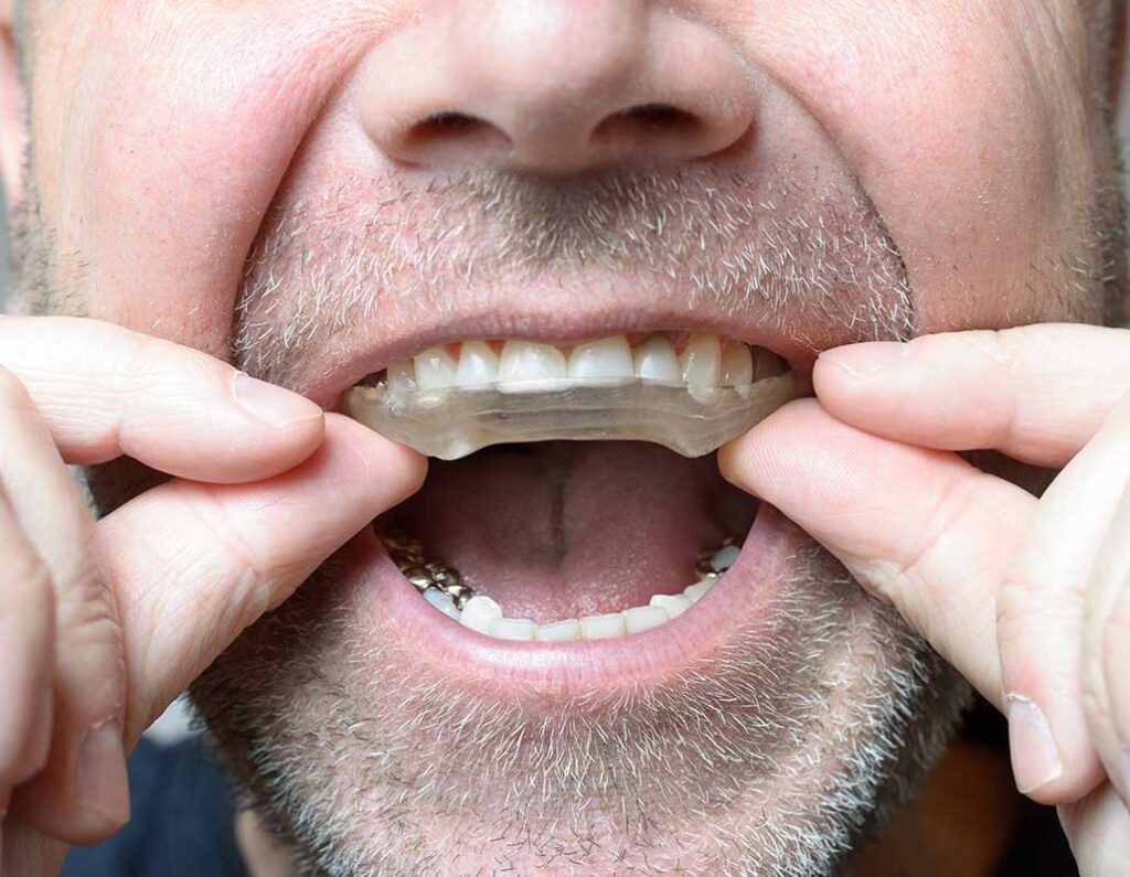 mouth night guard