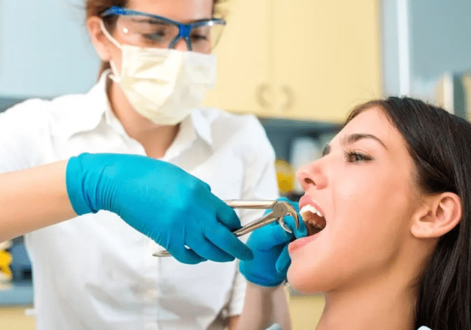 tooth extratcion 1024x729 1, Tooth Extractions
