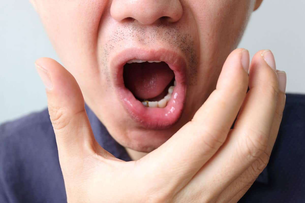 A man with his mouth wide open, Nightguards