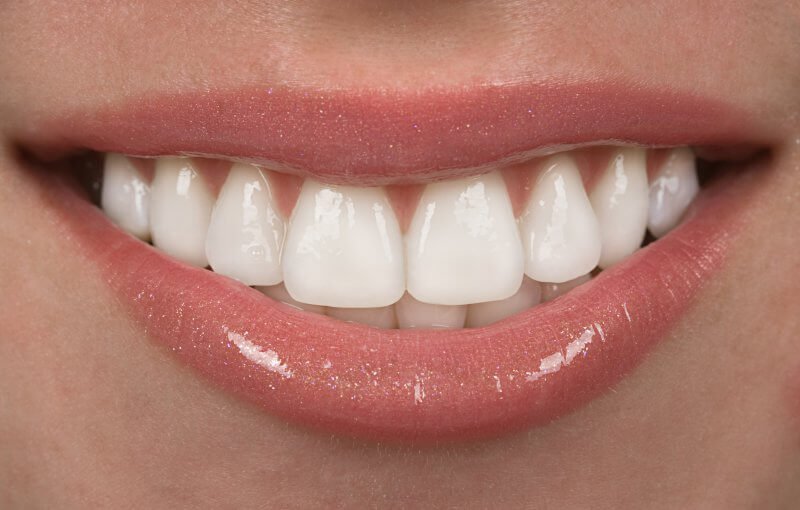 Photo for Are Porcelain Veneers in Harris County Permanent? Find Out Today!