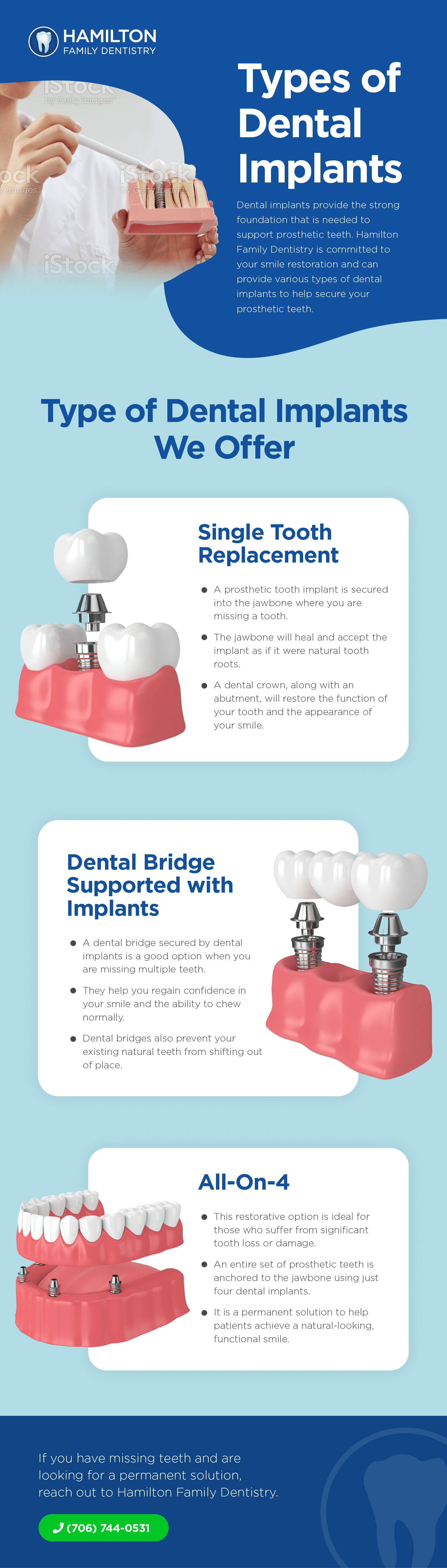 HFD Feb22, Types of Dental Implants