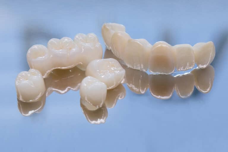 Zirconium Metal Free Dental Crowns, Crown vs Filling: A Detailed Guide for Unbeatable Oral Health
