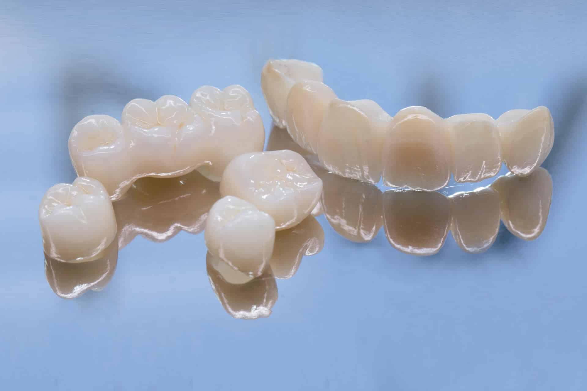 Photo for Crown vs Filling: A Detailed Guide for Unbeatable Oral Health