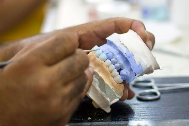 a full mouth dental implant model, What Is The All On X Treatment?