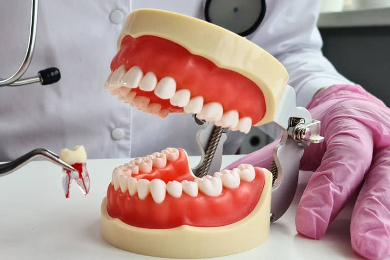 Photo for Why Would I Get Dental Implants After a Tooth Extraction?