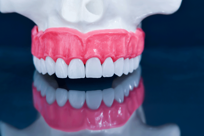 Photo for The Four Types Of Dental Implant Restorations