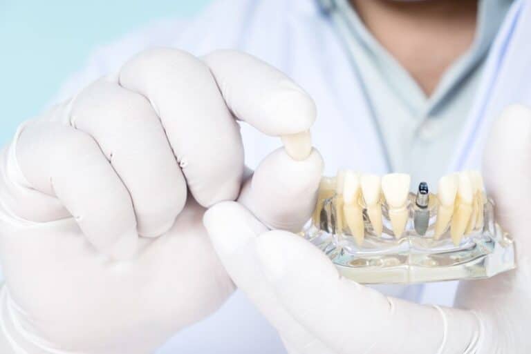 an implant dentist holding a dental implant crown and model, Can Anyone Have A Temporary Prosthesis Placed After Having Dental Implant Surgery?
