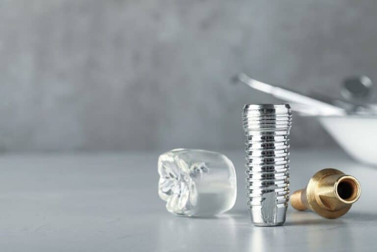 dental implant post model, Dental Implant Posts Can Improve Your Oral Health