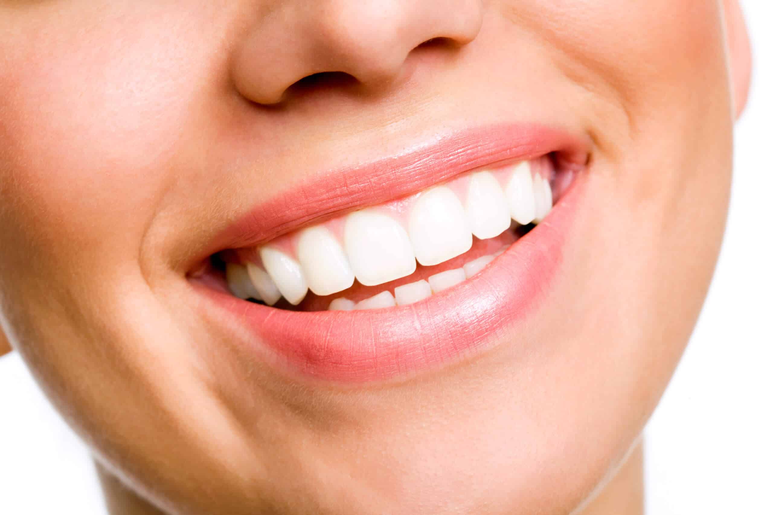 Photo for Do Home Teeth Whitening Kits Work?