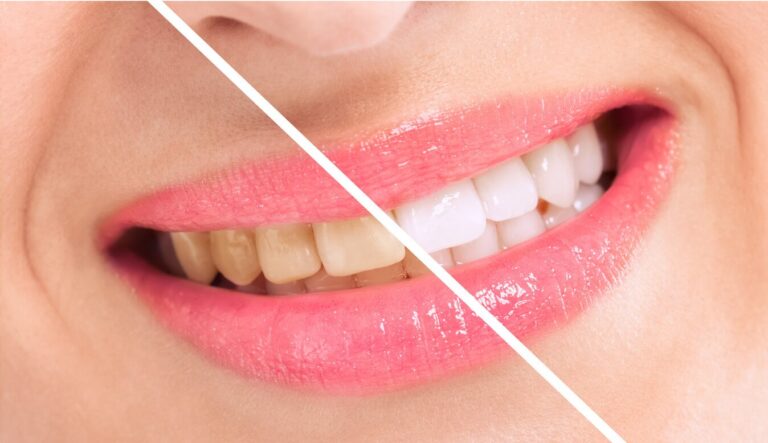 iStock 4988369661, Your Cosmetic Dentist in Hamilton, GA Fixes Smile Flaws