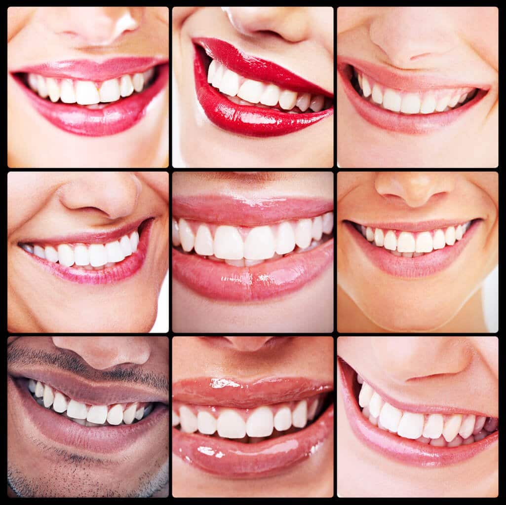 Photo for Quick, Easy Smile Fix from Your Cosmetic Dentist in Hamilton