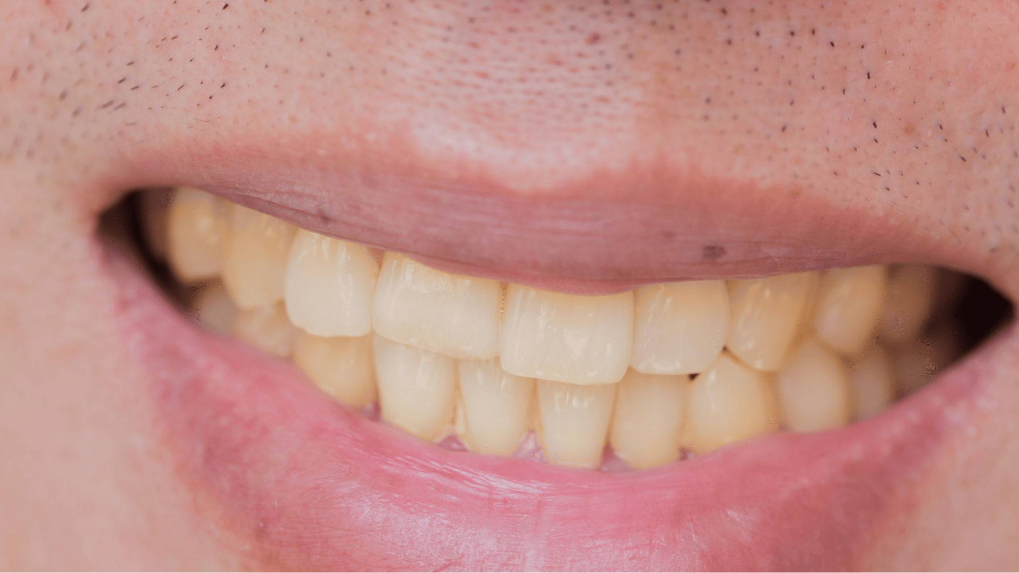 Photo for Foods That Cause Teeth Stains