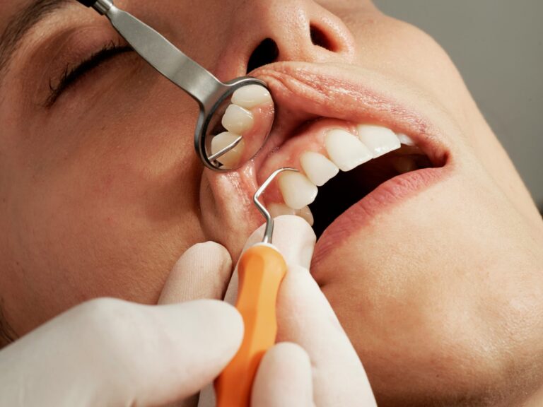 teeth cleaning scaled 1, Find Out How Much Teeth Cleaning Costs Without Insurance