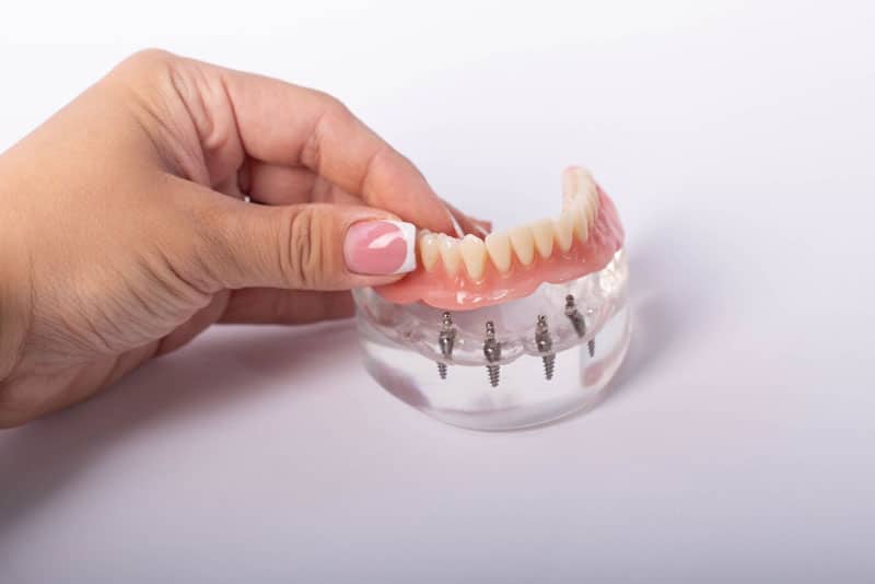 dentures 4, Dentures