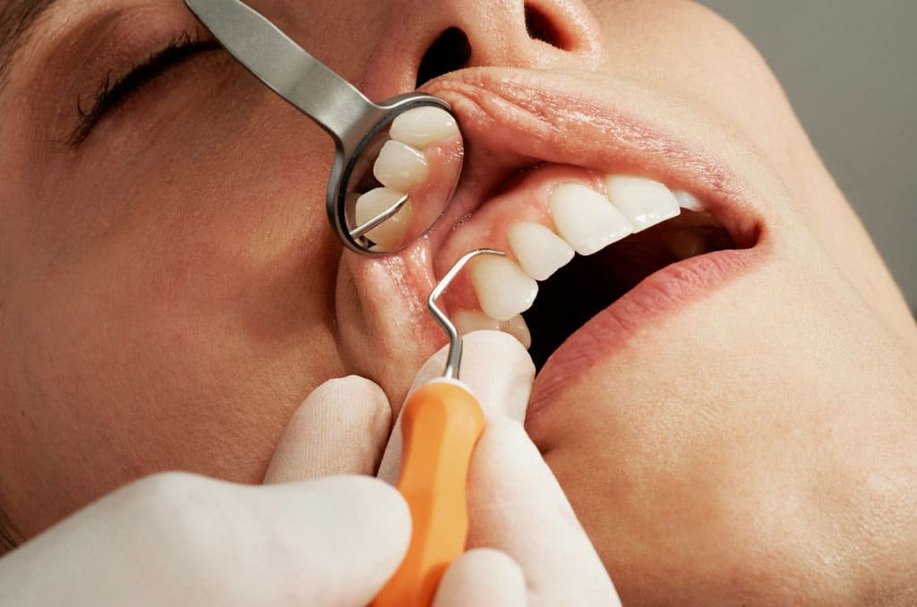 Dentist checking tooth