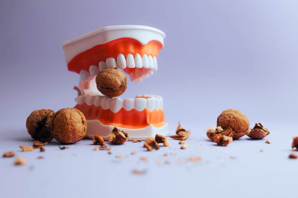 teeth cracking a walnut, Emergency Dentistry