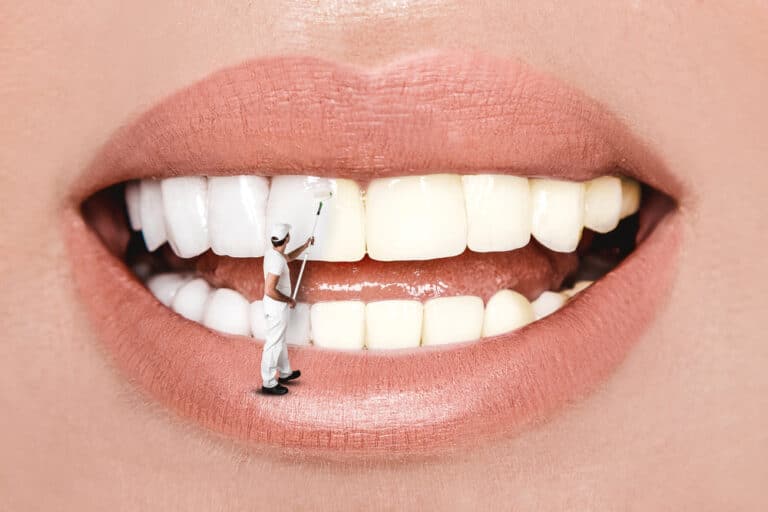 shutterstock 1675050271 1, Is a Smile Makeover Right for You?