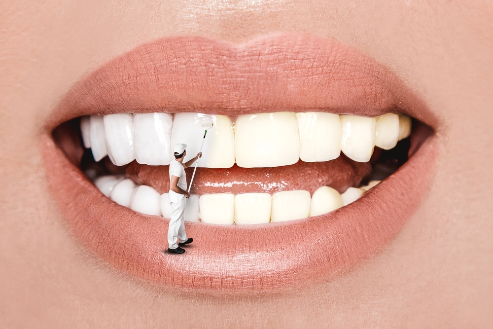 Photo for Is a Smile Makeover Right for You?