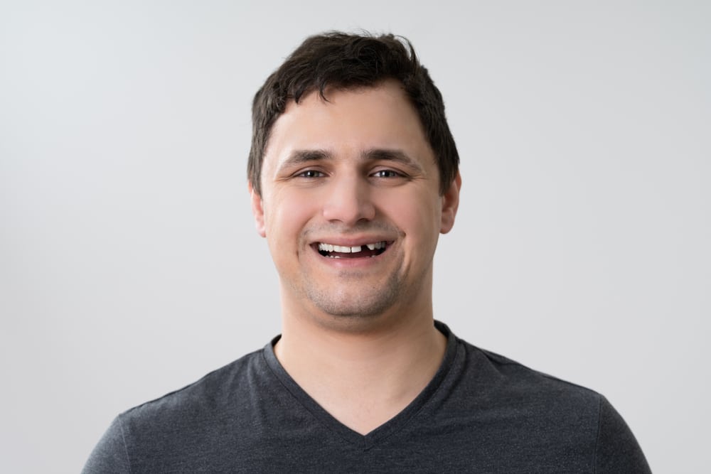 Photo for Missing Teeth? Let’s Talk About Your Options