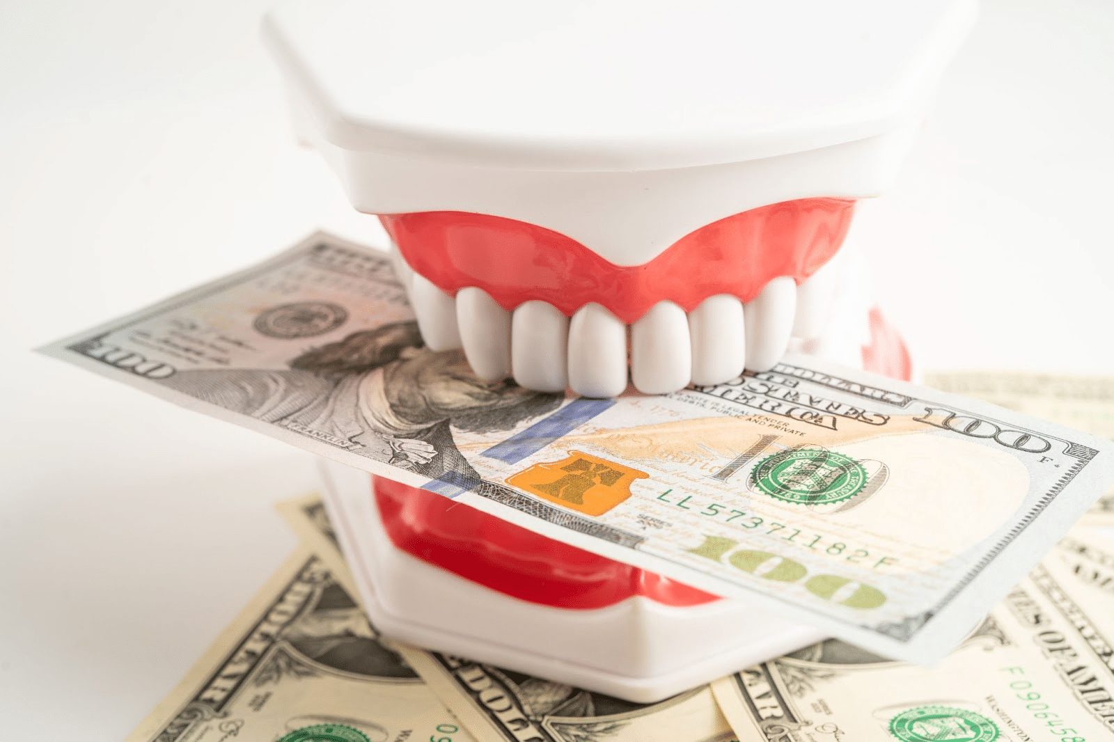 Photo for Single Tooth Implant Cost: Everything You Should Know