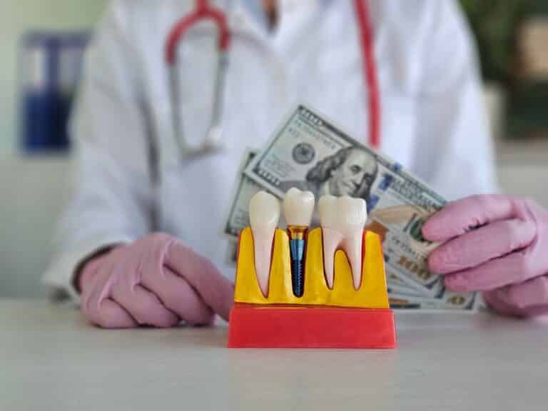 dental implant model, How Much Do All-on-4 Dental Implants Cost?