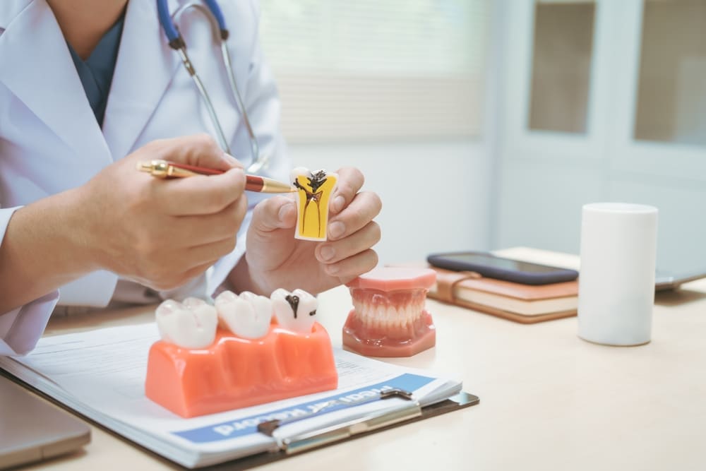 Is It Possible to Have a Root Canal Done in One Visit? 2 A dentist explaining root canal treatment on a tooth model