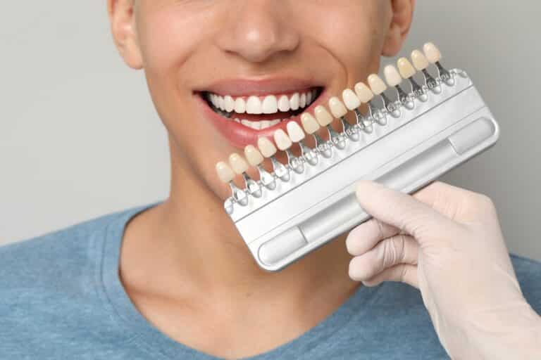 comparing veneers, Are Minimal-Prep Veneers Right for You? The Pros and Cons vs Traditional Veneers