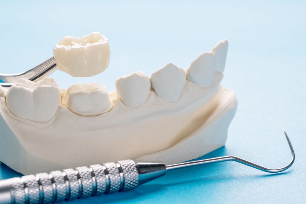 close-up of single tooth crown and bridge equipment