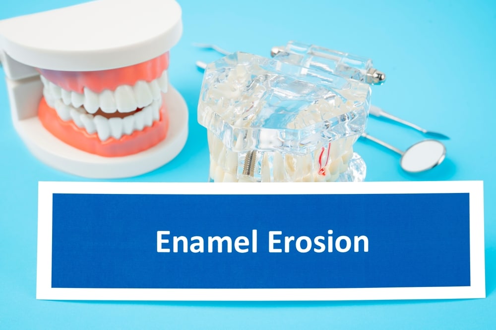 An enamel erosion sign, teeth model and dental tools on blue background